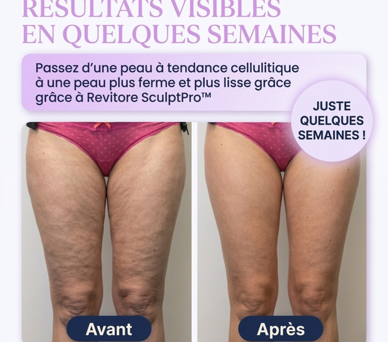 Revitore SculptPro™