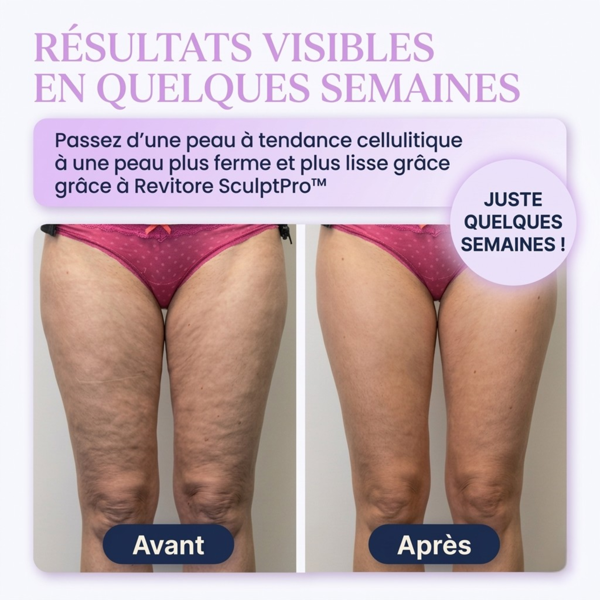 Revitore SculptPro™